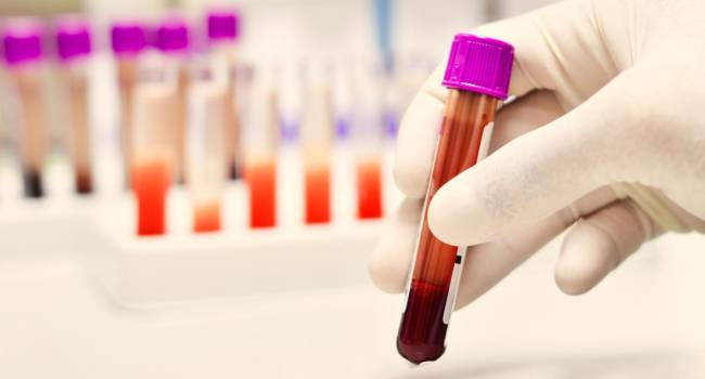 Hoy 17 de abril, Día Mundial de la Hemofilia 