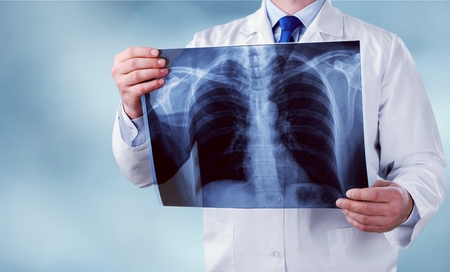 Hoy 5 de mayo, Día Mundial de la Hipertensión Pulmonar