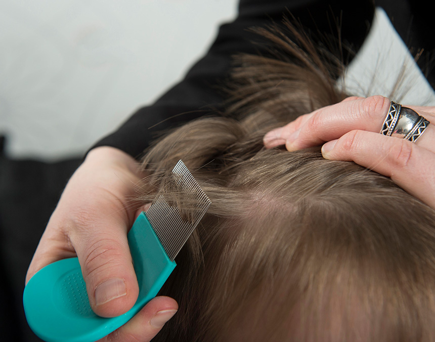Cómo tratar la pediculosis